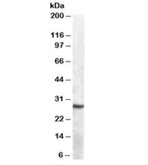 APOBEC1 Antibody