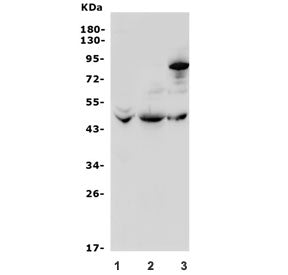 ADRB3 Antibody / Beta-3 Adrenergic Receptor
