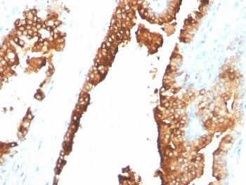IHC staining of FFPE human spleen with CDw75 antibody (clone ZB55). HIER: boil tissue sections in pH