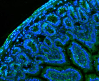 Cd147 Antibody / Emmprin / Basigin