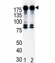HER2 Antibody (ErbB2, NEU)