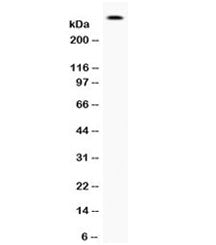 Western blot testing of human 22RV1 cell lysate with Filaggrin antibody. Predicted molecular weight 