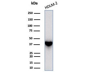 Western blot testing of human HDLM-2 cell lysate with STING1 antibody (clone STING1/7437). Predicted
