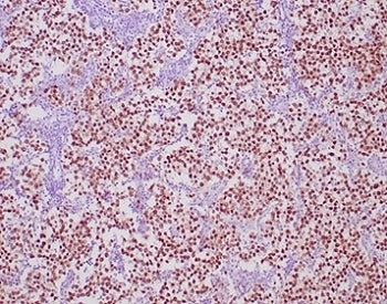 Oct4 Antibody / POU5F1