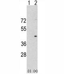 Aurora-A Antibody (AURKA)