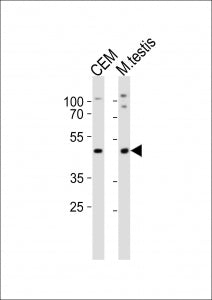 Western blot analysis of lysate from CEM cell line, mouse testis tissue lysate (left to right) using