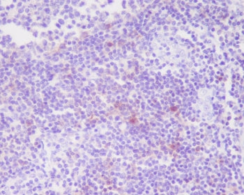 CD25 Antibody / IL2RA