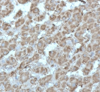 IHC staining of FFPE human liver tissue with recombinant DNA topoisomerase I antibody (clone rTOP1MT
