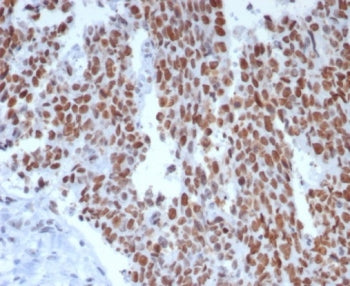 MSH6 Antibody