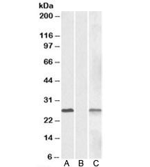 DYDC1 Antibody