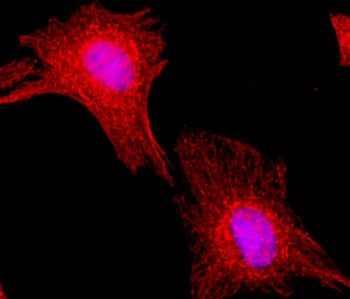 Alpha Tubulin Antibody / TUBA1B