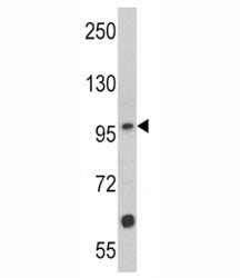 MUSK Antibody, 0.4ml