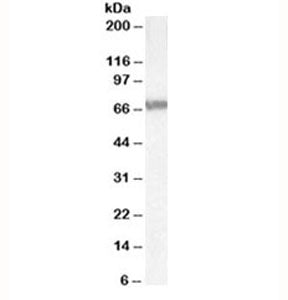 ABCD4 Antibody
