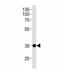 NKX1.1 Antibody