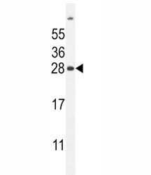 FAT10 Antibody