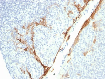 IHC testing of FFPE human tonsil with recombinant Cytokeratin 16 antibody (clone rKRT16/1714). Requi