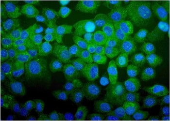 Immunofluorescent staining of FFPE human A431 cells with CDC123 antibody (green) and DAPI nuclear st