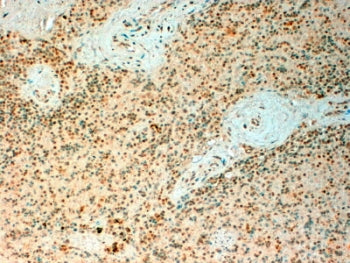TET2 Antibody