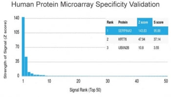 Alpha-1-Antichymotrypsin Antibody / AACT / SERPINA3