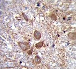 Cytospin A Antibody / SPECC1L