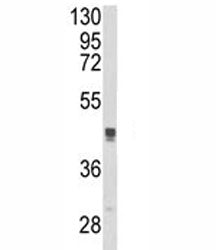 Western blot analysis of TGN46 antibody and MCF-7 lysate. Expected molecular weight: 38-120 kDa depe