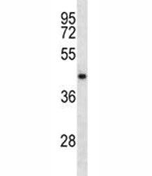 NDRG2 Antibody