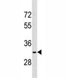 NKX6.2 Antibody