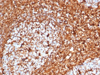 IHC staining of FFPE human tonsil tissue with recombinant Vimentin antibody (clone VIM/6576R). HIER: