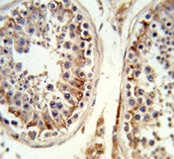 Integrin beta 3 Antibody
