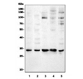 Western blot testing of 1) human HeLa, 2) human K562, 3) rat PC-12, 4) mouse NIH 3T3 and 5) mouse RA
