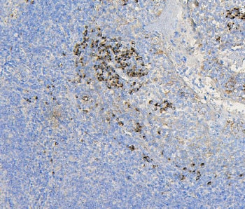 COPE Antibody / Coatomer subunit epsilon