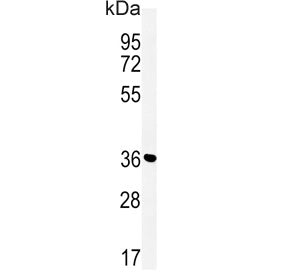 Mitoferrin-2 Antibody / MFRN2 / SLC25A28