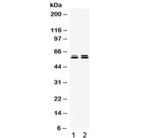 TCP1 epsilon Antibody / CCT5