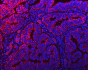 TOMM40 Antibody