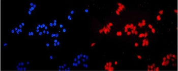 ETV5 Antibody / ETS Translocation Variant 5