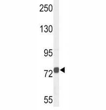 Western blot analysis of ChAT antibody and NCI-H460 lysate. Predicted molecular weight ~83/74 kDa (i