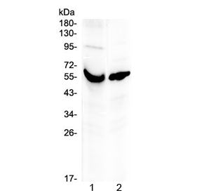 VDBP Antibody / Vitamin D binding protein