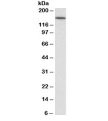 Western blot testing of human kidney lysate with CD13 antibody at 0.03ug/ml. Predicted molecular wei