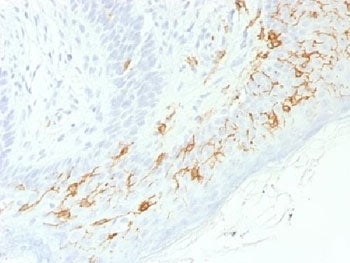 CD1a Antibody