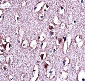 LMO2 antibody immunohistochemistry analysis in formalin fixed and paraffin embedded human brain tiss
