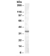 Western blot testing of K562 lysate with BDKRB1 antibody at 2ug/ml. Predicted molecular weight: ~40kDa, but can be observed at ~35kDa.