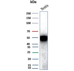 Western blot testing of human testis tissue lysate with Inhibin alpha antibody. Predicted molecular 