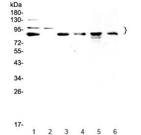 TPX2 Antibody / Targeting protein for Xklp2 / p100