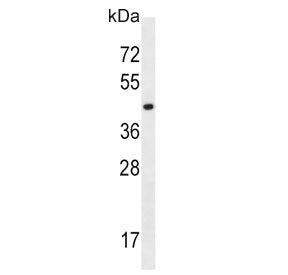SLC16A10 Antibody / MCT10