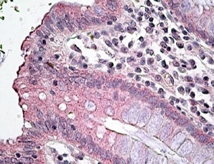 IHC testing of FFPE human colon with SLC12A2 antibody at 4ug/ml. HIER: steamed with pH6 citrate buff