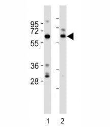 Western blot testing of SOX11 antibody at 1:2000 dilution. Lane 1: rat brain lysate; 2: human brain 