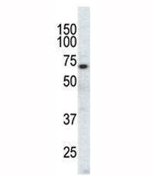 Western blot analysis of EphA3 antibody and CHO cell lysate. Predicted molecular weight: 110/61 kDa 