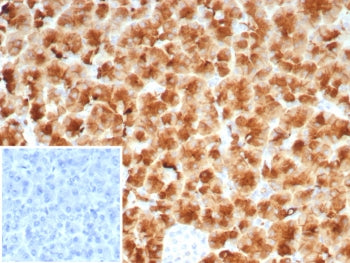 IHC staining of FFPE human pancreas tissue with recombinant GP2 antibody (clone rGP2/8617). Inset: P
