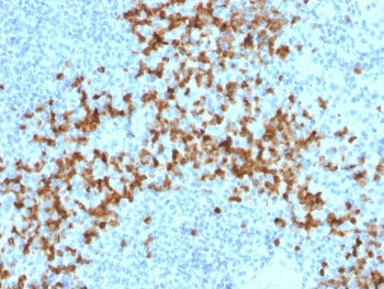 MMP9 Antibody / Matrix metalloproteinase-9