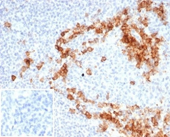 IHC staining of FFPE human tonsil tissue with recombinant CD38 antibody (clone CD38/7017R). Negative
